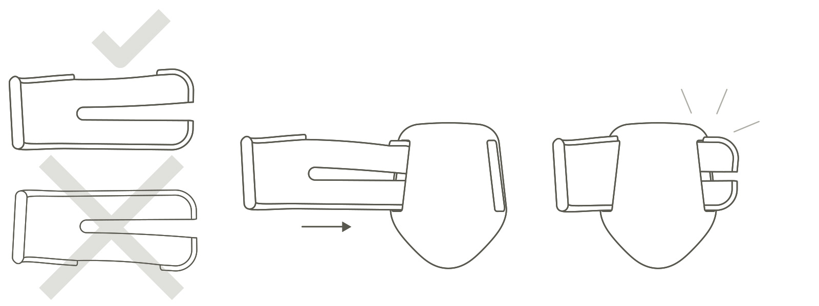 6 Inserting the clip (spring 1 or 2) into the clamp head